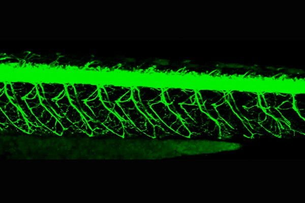 Motoneurones de poisson-zèbre (Zebrafish) : Les motoneurones sont marqués par la GFP (green fluorescent protein). Ce marquage permet de visualiser les motoneurones en situation normale ou après inactivation de gènes. © Inserm/Leclerc, Philippe
