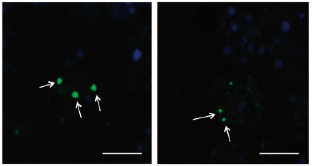 Réduction de taille et de nombre des agrégats de protéines anormale dans le cerveau des souris ataxiques traitées avec l’interféron.