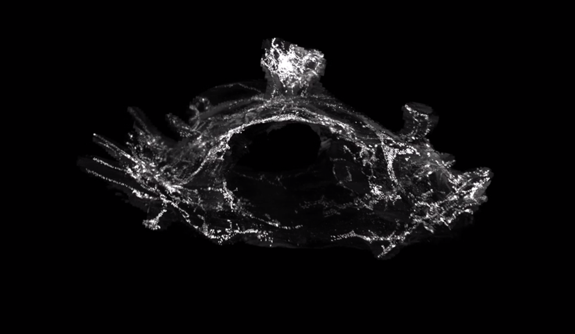 Cartographie des vaisseaux lymphatiques vertébraux en 3D