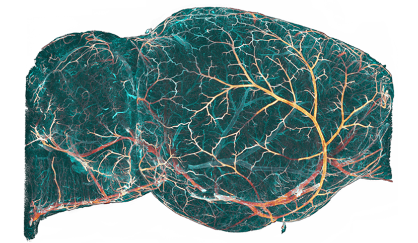 Mouse brain imaged in 3D by light sheet microscopy