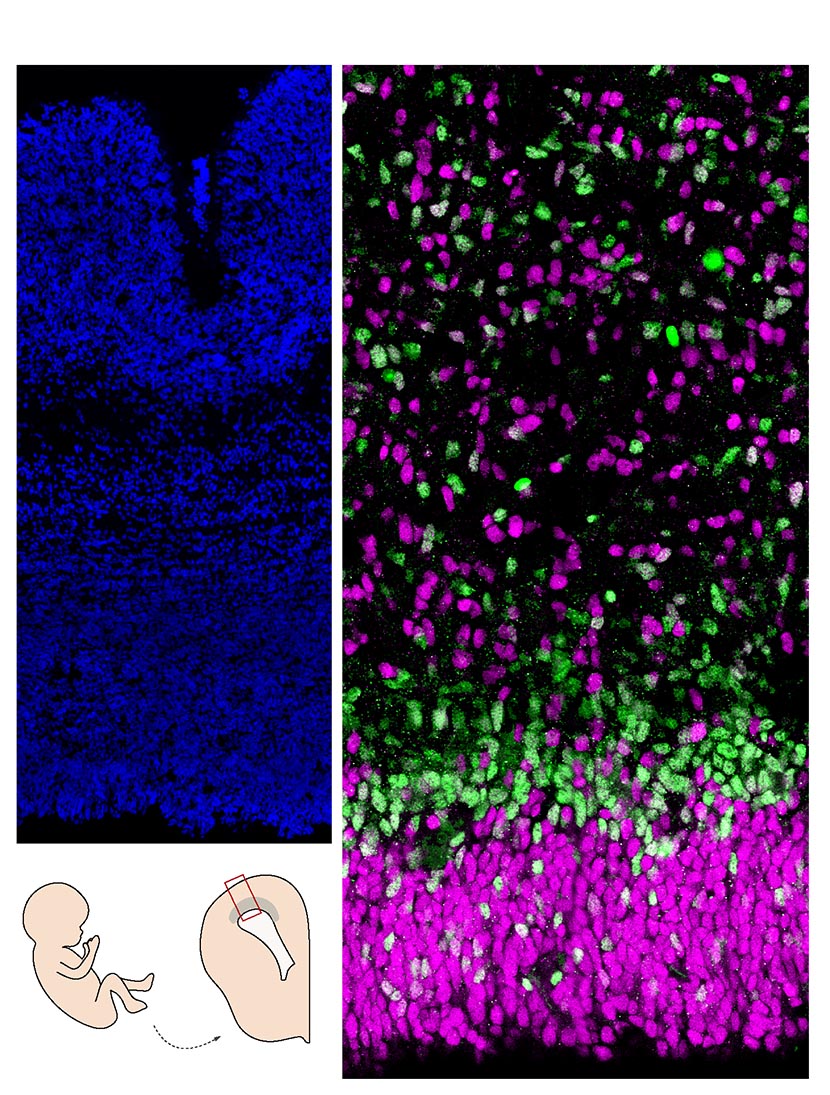  Coupe de cerveau humain (cortex). A gauche, les noyaux sont marqués en bleu; à droite, les cellules progénitrices en magenta sont moins engagées dans la différentiation neuronale que celles en vert.