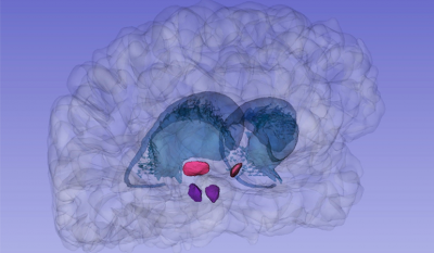 Illustration 3D des noyaux subthalamique