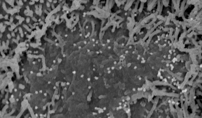 Microscopie électronique à balayage montrant les changements de l’épithélium olfactif après infection par le SARS-CoV-2. A la périphérie de la photo, les cellules ciliées sont normales. Au centre : perte de cils 2 jours après infection. Les particules virales bourgeonnent à la surface des cellules infectées ayant perdu leurs cils. © Unité Perception et Mémoire – Institut Pasteur