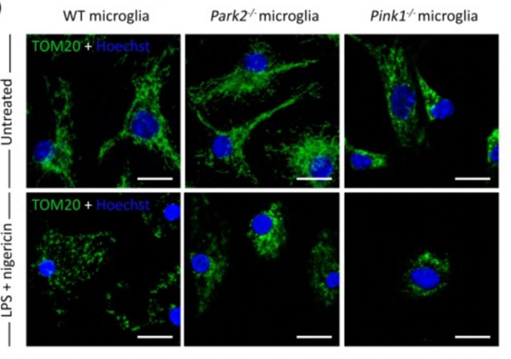 Microscopie confocale du réseau mitochondrial (en vert) des cellules microgliales, témoins ou mutées pour Park2 ou Pink1, non traitées ou après traitement LPS + nigericin (inducteur de l'inflammation)