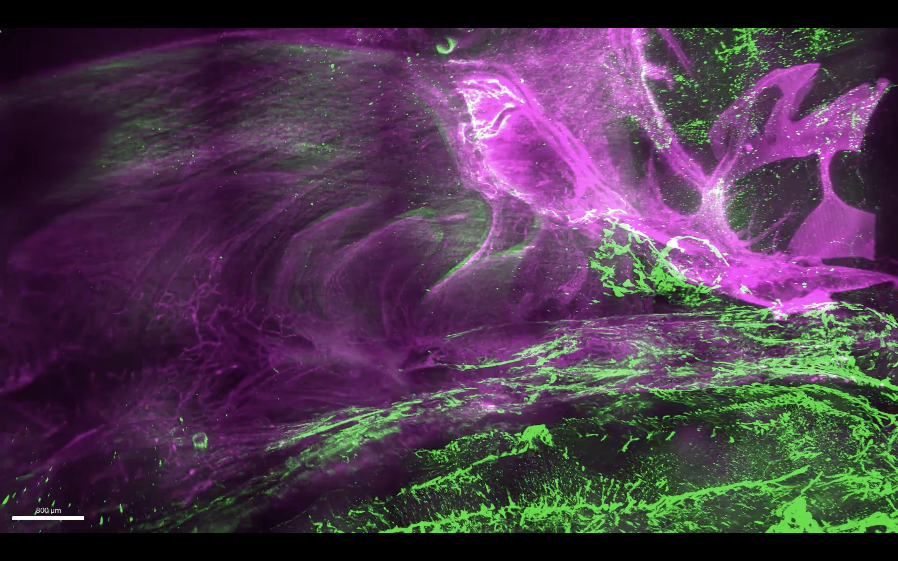 La cartographie 3D du réseau lymphatique méningé