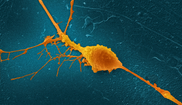 Neurone de la rétine